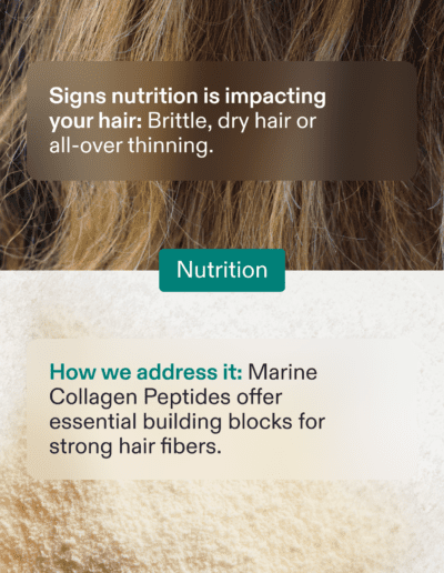 Nutafol 6 Root Causes Ayur Interventional and Vascular Care